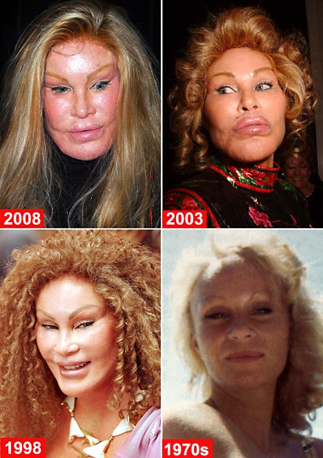 http://www.onlinenursingdegrees.org/images/jocelyn-wildenstein.jpg