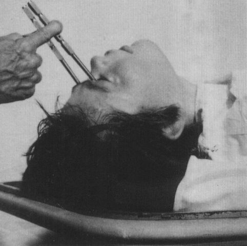 http://www.onlinenursingdegrees.org/images/lobotomy.jpg