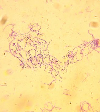 Anthrax Bacterium.