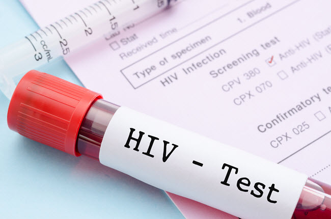 HIV Test.